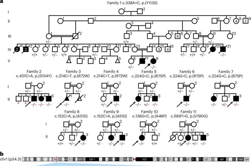 Ribosome level changes detected in early brain development